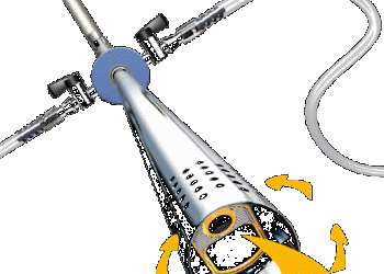 Percutaneous Nephroscopes