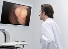 EVIS EXERA III for Gastroenterology