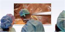 Three surgeons in scrubs facing a high-definition screen display of a magnified view of a laparoscopic instrument inserted in tissue.