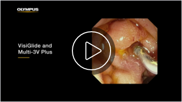 Play Video - Dr. Loren Clinical Video