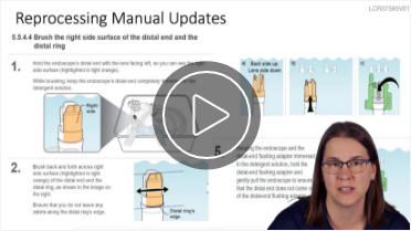 Play Video - Flushing Out the Facts on Duodenoscopes